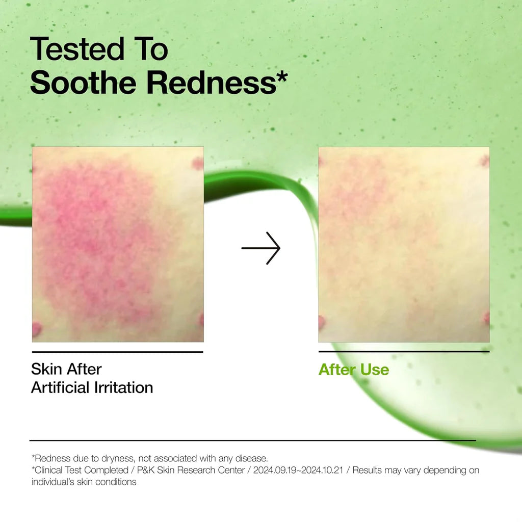 [ANUA]-Azelaic Acid 10 Redness Soothing Serum 30ml – Authentic Korean Skincare in Pakistan